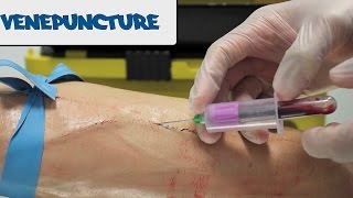 Venipuncture -  How to take blood - OSCE guide (old version)
