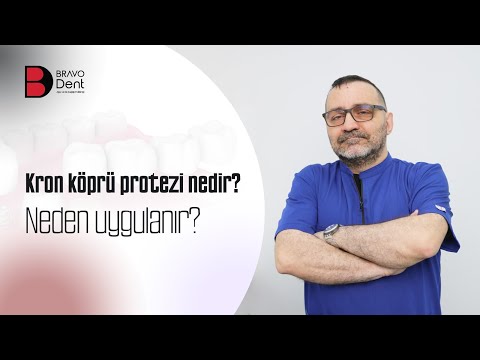 Kron köprü protezi nedir? Neden uygulanır? - BravoDent
