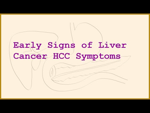HCC Symptoms: Recognizing Liver Cancer Early