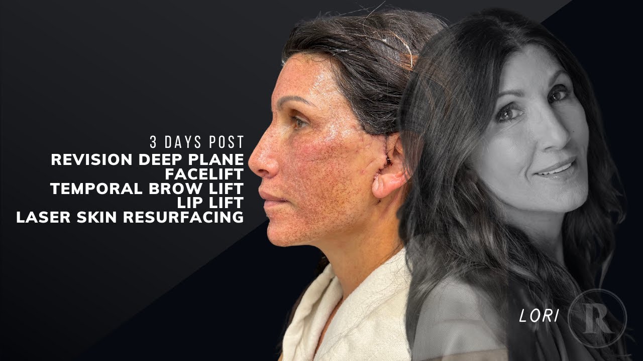 Robb Facial Plastic Surgery