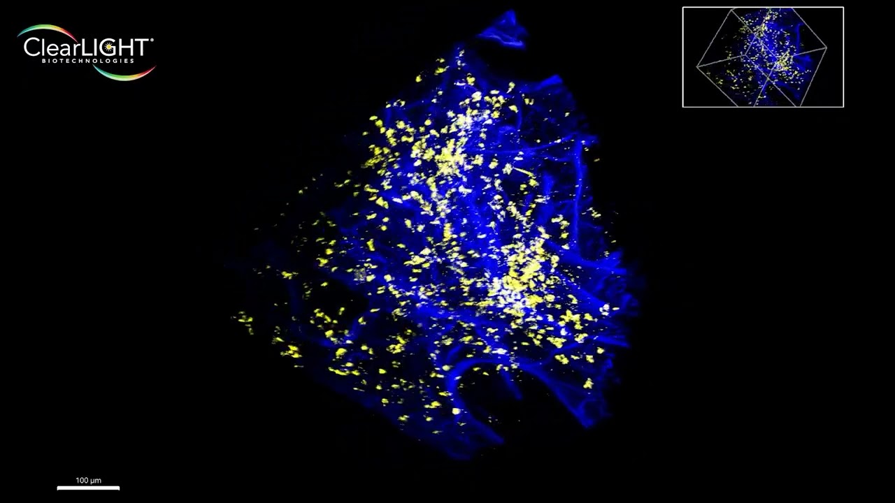 AACR 2022 Video Loop