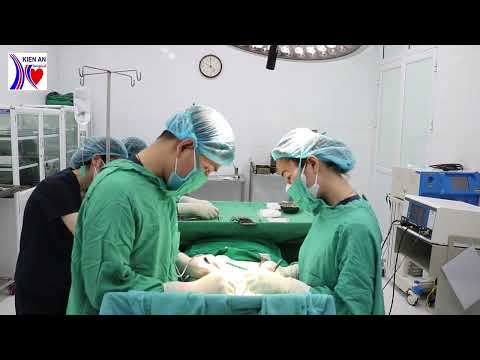 Phẫu thuật cắt hoàn toàn tuyến giáp + vét hạch trong ung thư tuyến giáp
