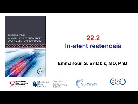 22.2 In-stent restenosis: Manual of PCI