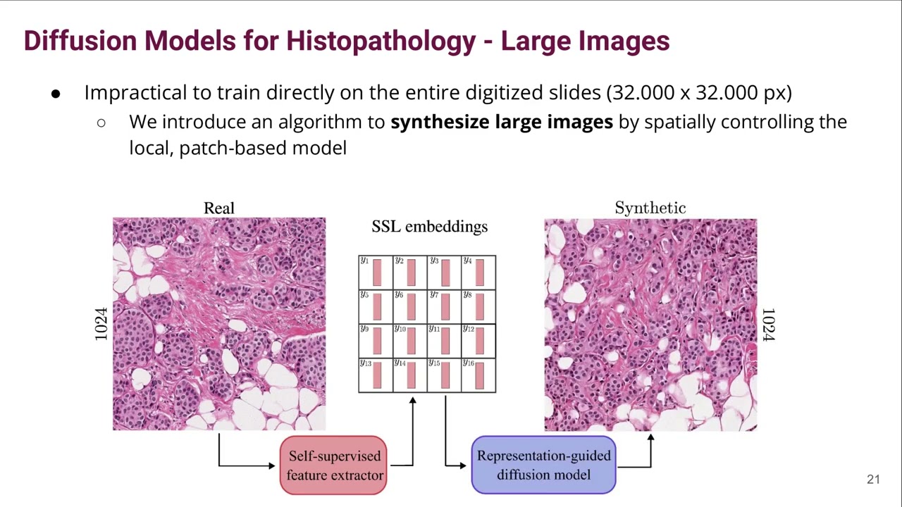 Learned representation-guided diffusion models for large-image generation - CVPR 2024