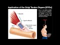 Function of Golgi Tendon Organs [GTOs] in Movement & Exercise