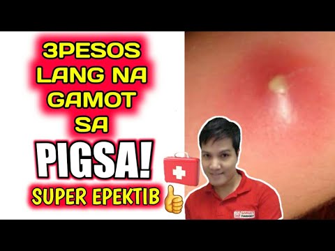 download lagu mp3 mp4 Where To Buy Koyo For Boils, download lagu Where To Buy Koyo For Boils gratis, unduh video klip Where To Buy Koyo For Boils
