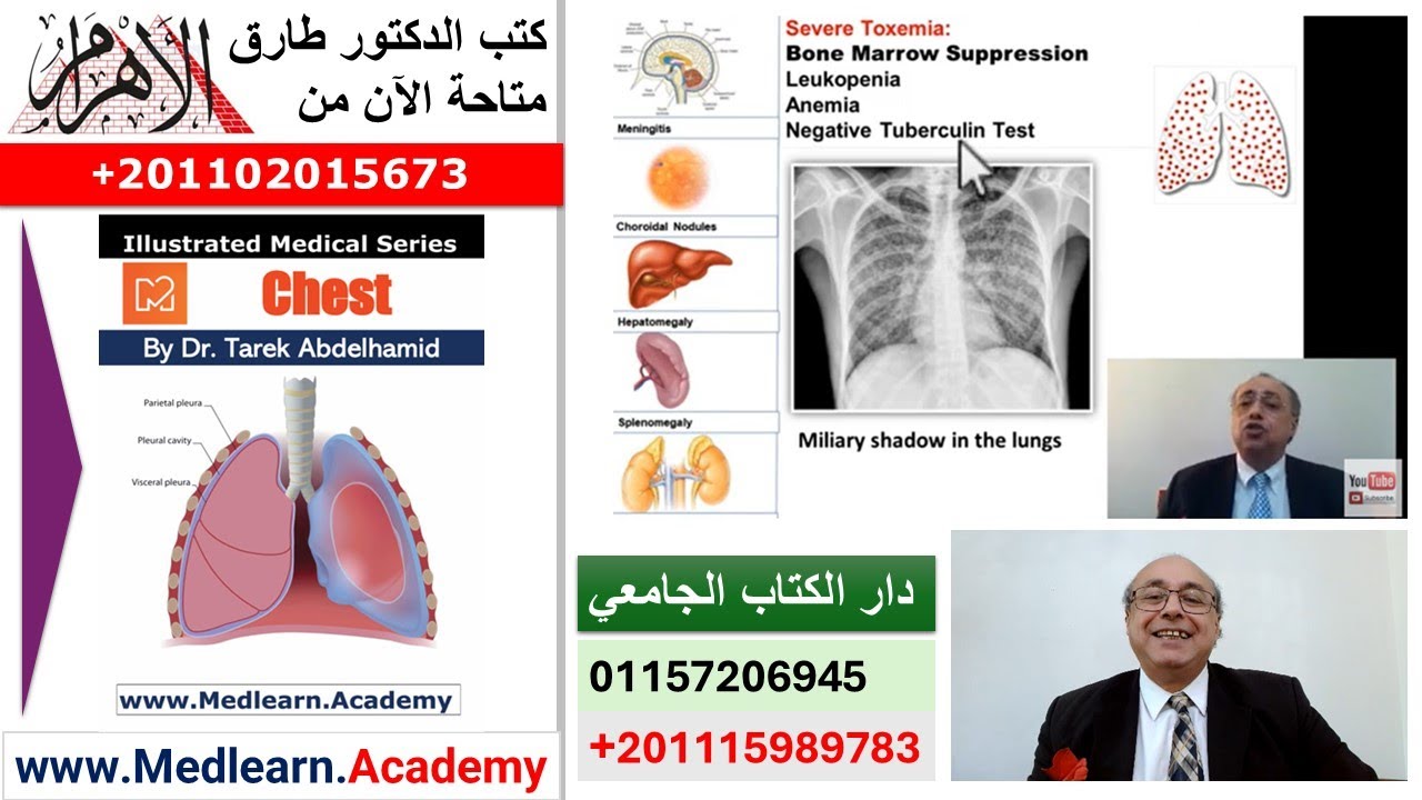 Tuberculosis (IV)   #cme #internal_medicine #medical #usmle #محاضرات_باطنة #medicalstudent