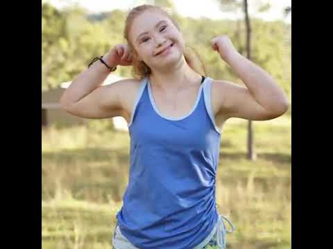 Madeline Stuart_A Down Syndrome Model_Inclusive Education