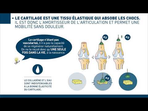 TRAITEMENT DE L'ARTHROSE : Les traitements non chirurgicaux