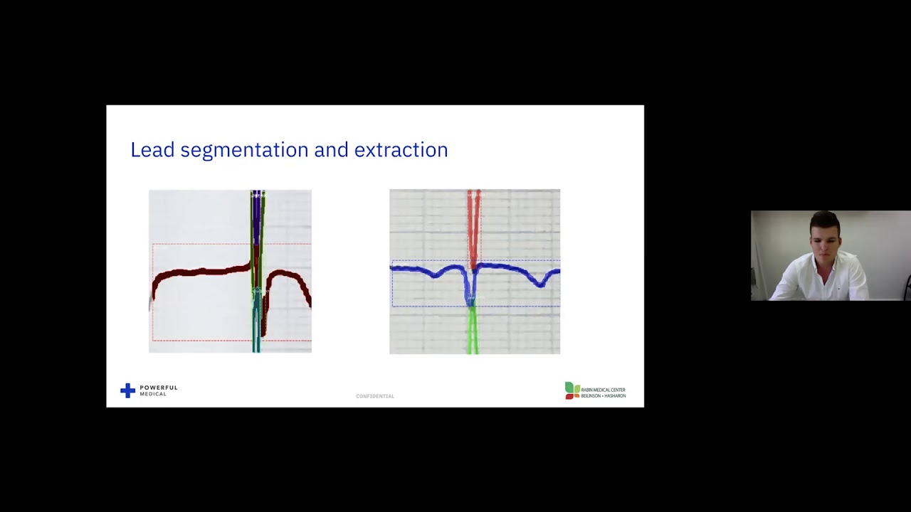 Rabin Medical Center 2020 - AI-powered ECG Interpretation