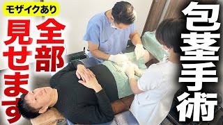【全部見せ】包茎手術のリアル風景！「冬でも立派なペニスでいたい」
