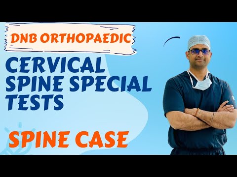 Special Tests - Cervical Spine (DNB/MS practical Orthopaedics examination)