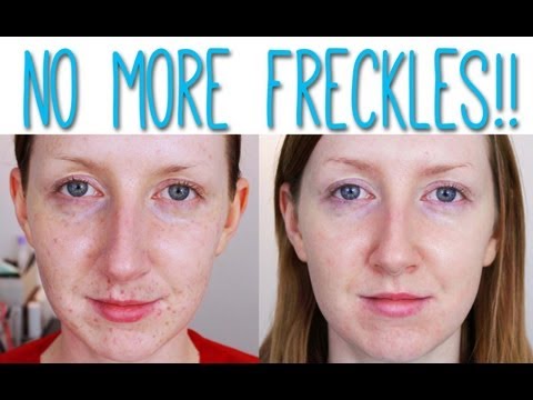 Decolorazione del perossido di idrogeno di persona Comprare la crema per il viso da pigmentary nota in Mosca