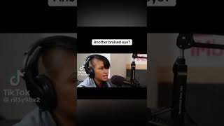Cassie Covering Bruise On Her Eye During Radio Interview #diddy #cassie #diddytrial #cassieventura