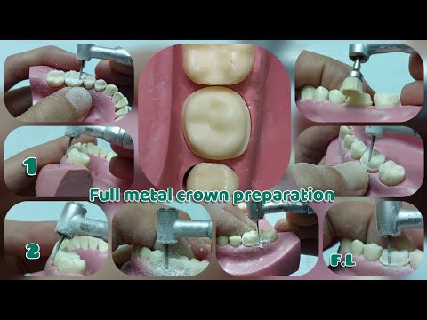 اسهل فيديو لتعليم Reduction for lower 6 _ full metal crown preparation