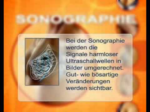 Osteochondrose rektifiziert Lordose der Halswirbelsäule Dass eine solche Freisetzung Gelenk