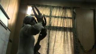 Obstetrics - Dr.Nadine Alaa sherif - Face & Brow presentations