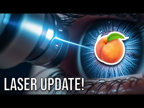 LASER Surgery Update! | Hemorrhoids, Anal Fistula, Pilonidal Cyst