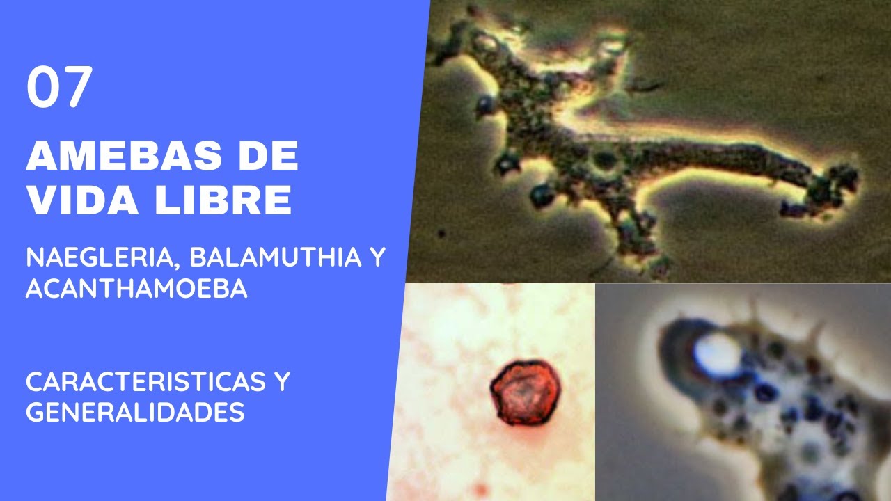 Free-living amoebas: Balamuthia, Acanthamoeba and Naegleria