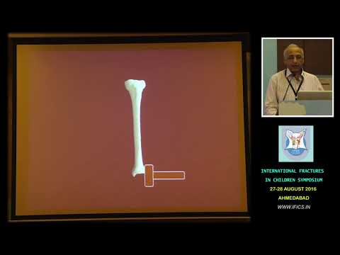 Dr Dhiren Ganjwala Basics of pediatric fractures