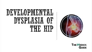 Developmental Dysplasia Of The Hip - A Clinical Overview for Medical Students