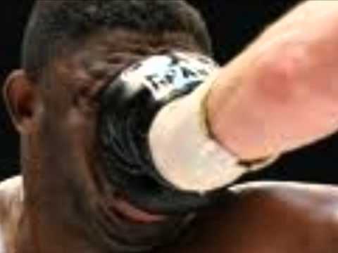 OTC YOUNG BOYS - Emergency