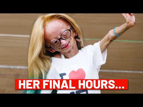 The Girl Who Ages Too Fast (R.I.P. Adalia Rose)