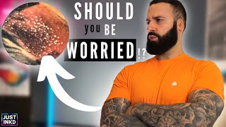 Dealing with PIMPLES, IRRITATION, RASHES &amp; INFECTION on a NEW TATTOO