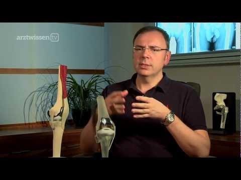 Übungsvideos während Exazerbation der Gebärmutterhals-Thorax-Osteochondrose Hks-303 Klammer einstellbar Kniegelenk