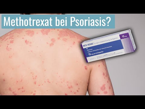 Hilft MTX bei Schuppenflechte und ist es gut verträglich?