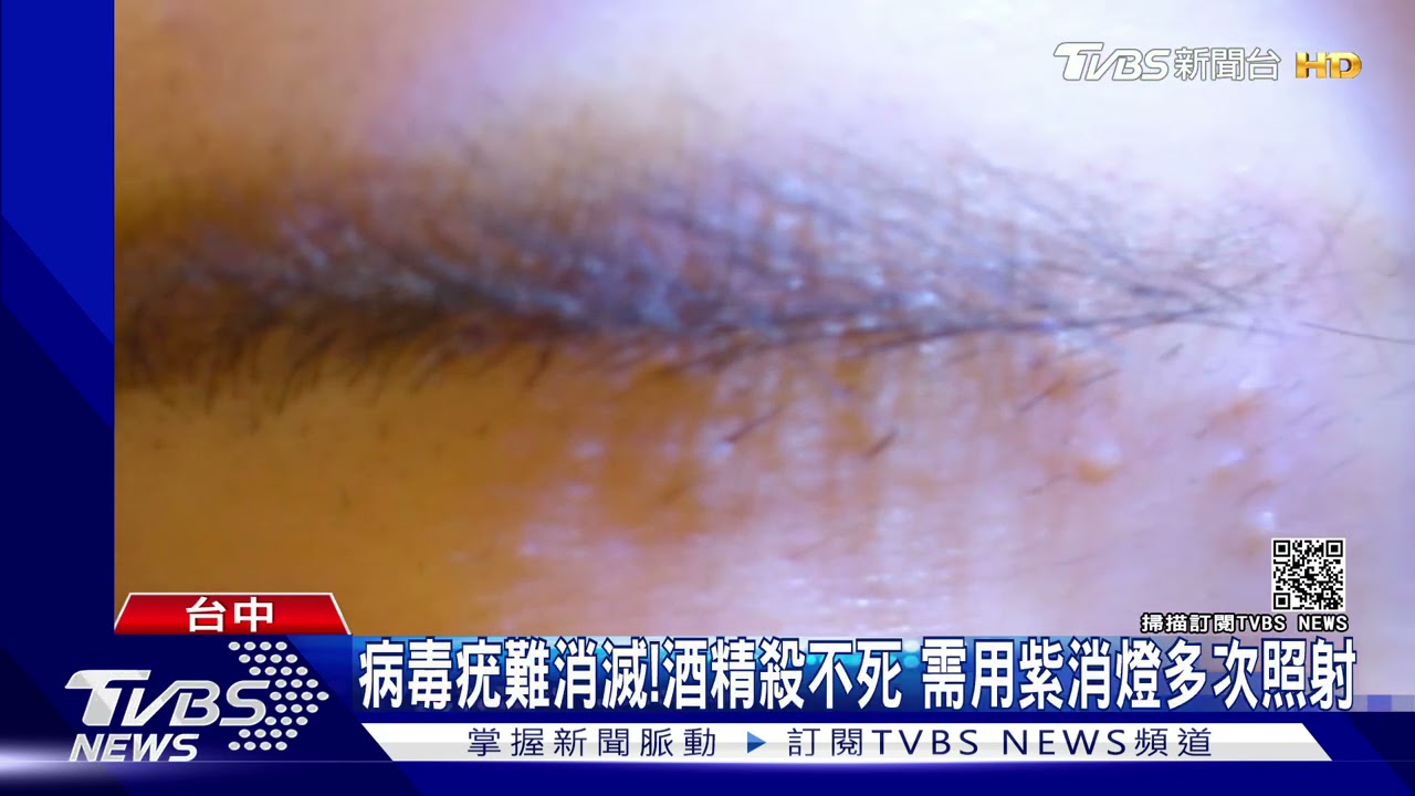 台中俏女郎紋眉險毀容！疑器具不乾淨　長50多顆病毒疣