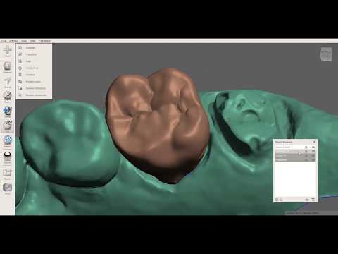 Meshmixer - Crown Design with Spacer (Magnet Tool Technique)