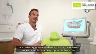 Tratamientos de Estética Dental y Ácido Hialurónico en Algeciras | Clínica Cooldent