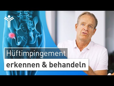 Recognize and treat hip impingement correctly – stop osteoarthritis 🛑