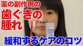 薬の副作用の症状を緩和する口腔ケアのコツ