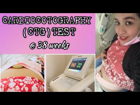 Cardiocotography (CTG) Test at 38 Weeks of Pregnancy