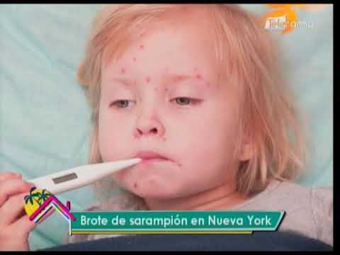 Brote de sarampión en Nueva York