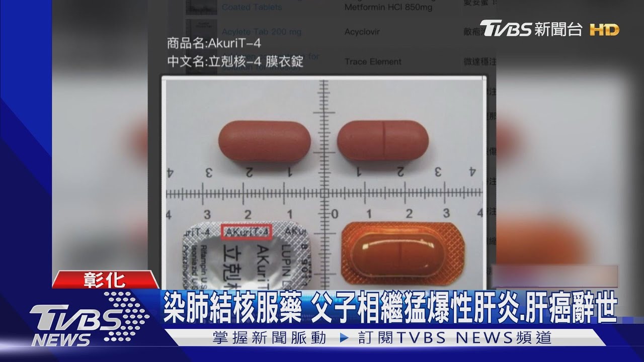 染肺結核服藥 父子相繼猛爆性肝炎、肝癌辭世