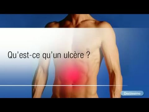 comment traiter un ulcere d'estomac