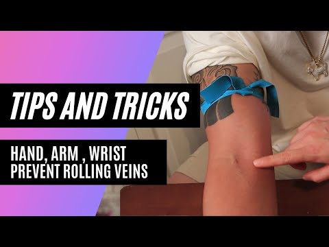 How to find a vein when starting IVs or drawing blood