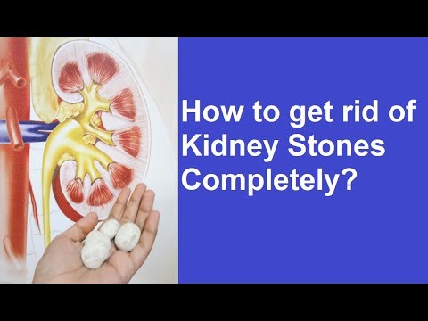 Complete Removal of Kidney Stones (PCNL or Keyhole Treatment), Dr. Raguram Ganesamoni (Urologist)