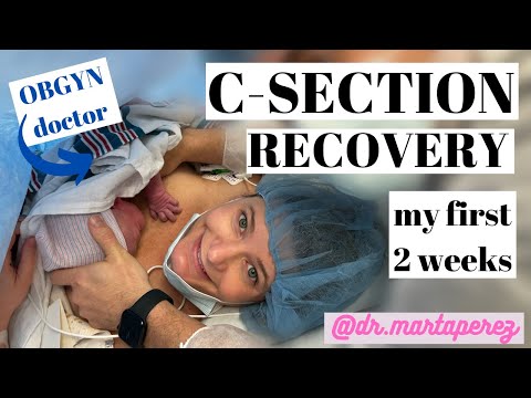 OB-GYN's C-section Recovery: First 2 weeks | Pain, Incision, & Abdominal Binder tips!