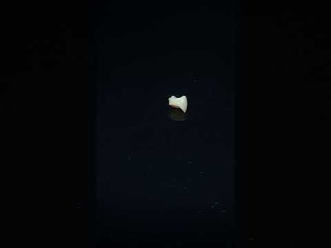 YouTube 썸네일