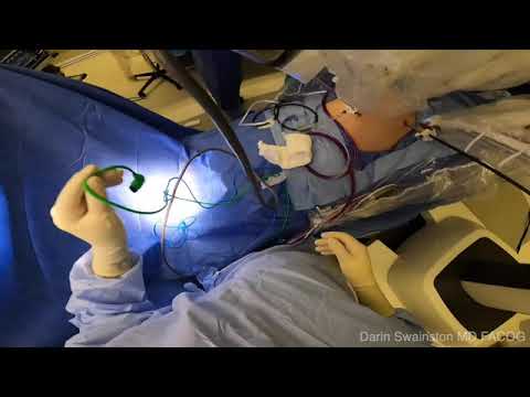 How-To | Intuitive Surgical Optical Trocar Placement & NEW ConMed AirSeal Robotic Solution