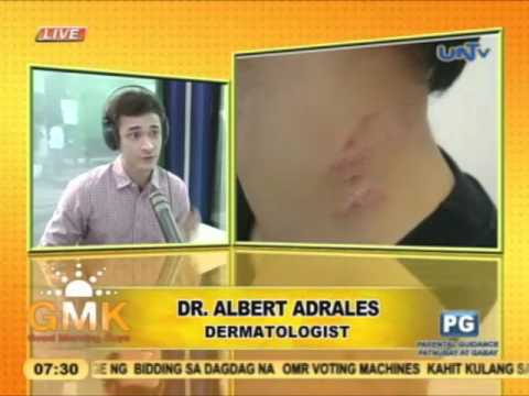 Seme di lino a dermatite atopic Oktenisept da psoriasi