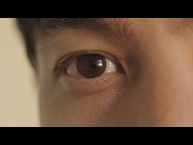 The Itch Trailer 1