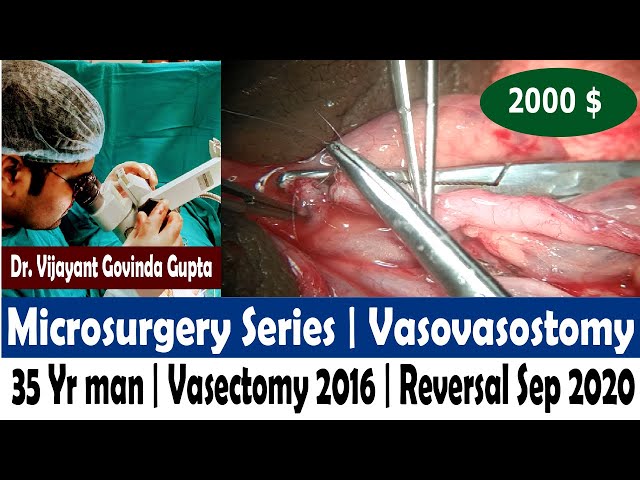 Video Uitspraak van vasovasostomy in Engels