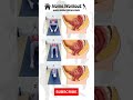 Pelvic Floor Muscles Repair Workout At Home Shorts Homeworkout Pelvicfloorhealth