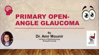 Primary Open Angle Glaucoma