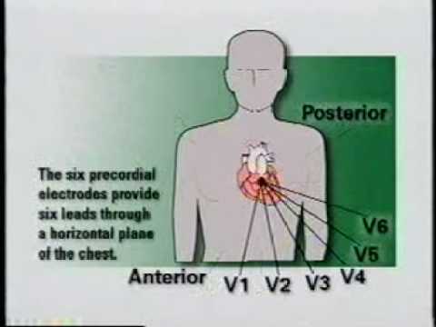 comment poser holter ecg